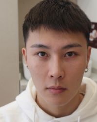 -大麦微针植发全国连锁