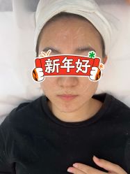 体验前-恒妍医美·韩国定制抗衰中心