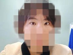 -黑马眼科·近视手术