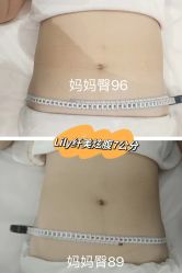 -Lily纤美·科技减脂中心