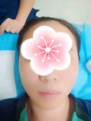 体验后-CMS西美斯·美式医疗美容