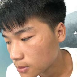 -痣斑堂·取大痣