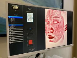 点击看大图 -苑苑vbeauty科技美容SPA