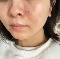 体验后-美莱医疗美容医院