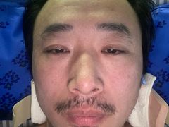 -上海永慈康复医院