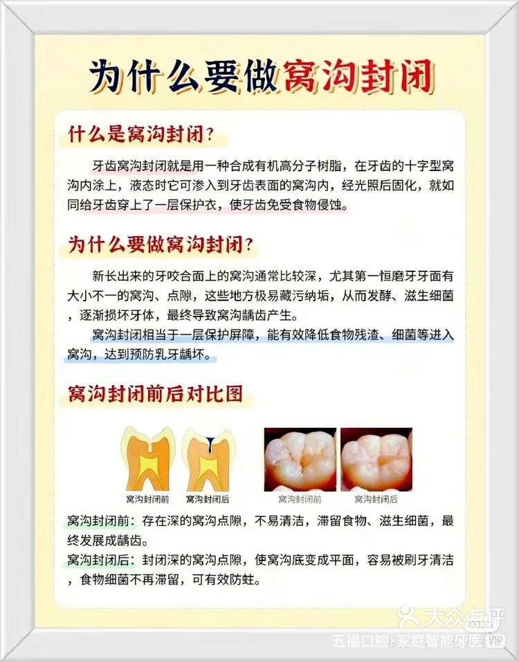 窝沟封闭那些事儿