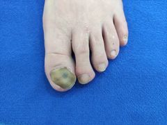 -世龙世家甲沟炎·灰指甲·嵌甲矫正·修脚(武侯区双楠店)