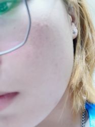 体验后-圣嘉新医疗美容医院