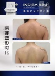-雅荷悦来双美