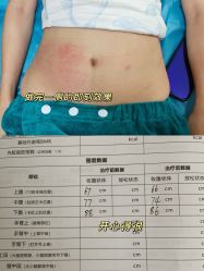 -美莱医学美容医院