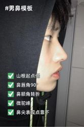 -北京米扬丽格医疗美容·联合丽格鼻整形中心