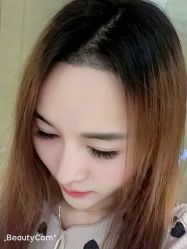 -大麦微针植发丨全国连锁