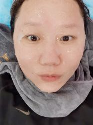 体验后-澳尔颜选医疗美容
