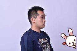 点击看大图 -大麦微针植发丨全国连锁