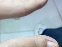 -新甲连锁灰指甲·甲沟炎·鸡眼(黑龙江路店)