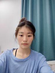 体验后-大麦微针植发丨全国连锁