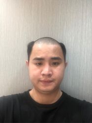 -发饰美男士增发补发假发定制店