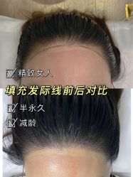 -MISS STAR·半永久纹眉·发际线·美瞳线