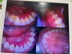 -爱牙联合口腔(门诊报销 海云庵店)