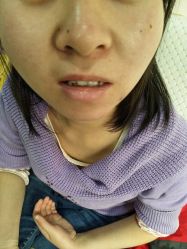 -北京美痣堂古方祛痣斑疣瘊