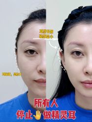 -上海伊莱美医疗美容医院