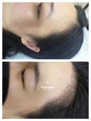 点击看大图 -西施无菌半永久纹绣眉眼影唇轻增发纹发际线