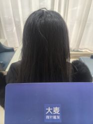 -大麦微针植发丨全国连锁