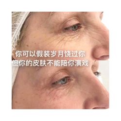 -香榭丽舍·海菲秀·皮肤管理痘敏肌修护