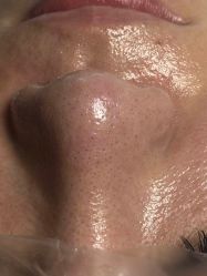 点击看大图 -美肤盾祛痘·问题肌头疗管理中心