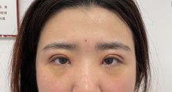 体验后-壹加壹医疗美容·轻医美·美容外科