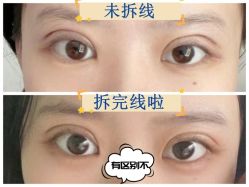 -素美医疗美容·西南眼鼻整形·修复基地