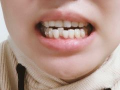 -深圳佑诺口腔门诊部