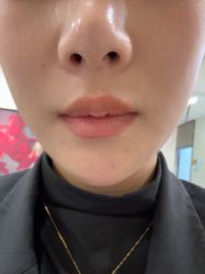 -长沙雅美医疗美容医院