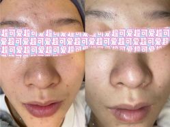 -EC BEAUTY易思美容