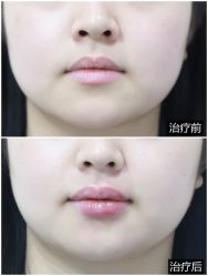 -美莱医学美容医院