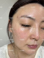 -SOS修丽可.痘肌修复中心