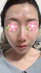 -针美汇欧邦医疗美容
