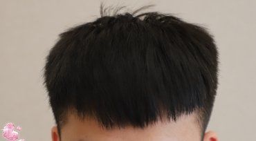 -大麦微针植发丨全国连锁