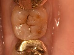 -精德口腔·种植修复·儿牙中心(财富中心店)