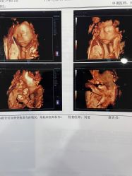 -济南艾玛妇产医院