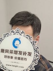 -唐风采假发补发定制