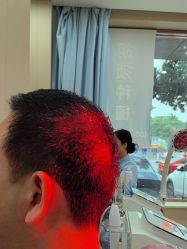 点击看大图 -大麦微针植发全国连锁