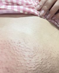 -小忠丽格医美