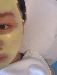 -中科新肌能祛痘祛斑