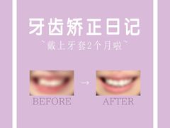 -极光口腔·矫正种植修复(锦江店)