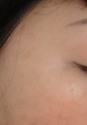体验后-重庆军美医疗美容医院