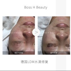 -Boss H Beauty美肌中心