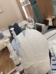 -广州紫馨整形外科医院