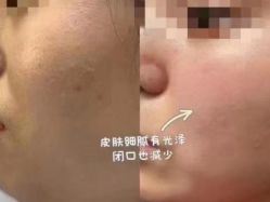 -Cream88颜皮肤管理中心