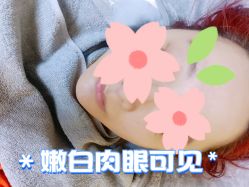 体验后-北京爱育华医院-医疗美容科